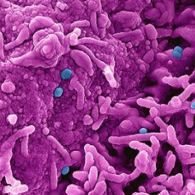 Monkeypox: Old Foe, New Movements